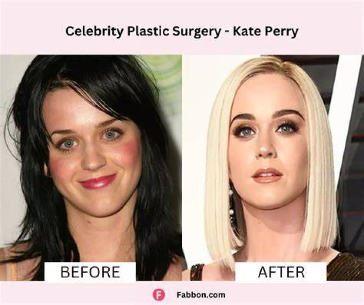 
Dawn French Plastic Surgery Before And After: Does She Have Cancer? 