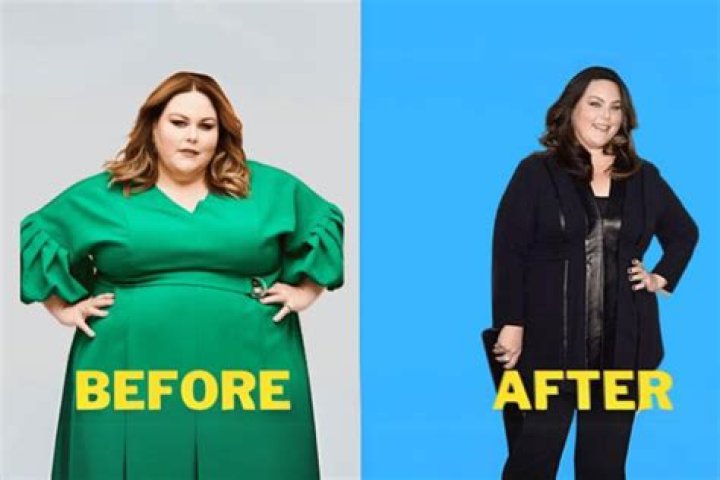 
Did Chrissie Swan Had Weight Loss Surgery? Before And After 