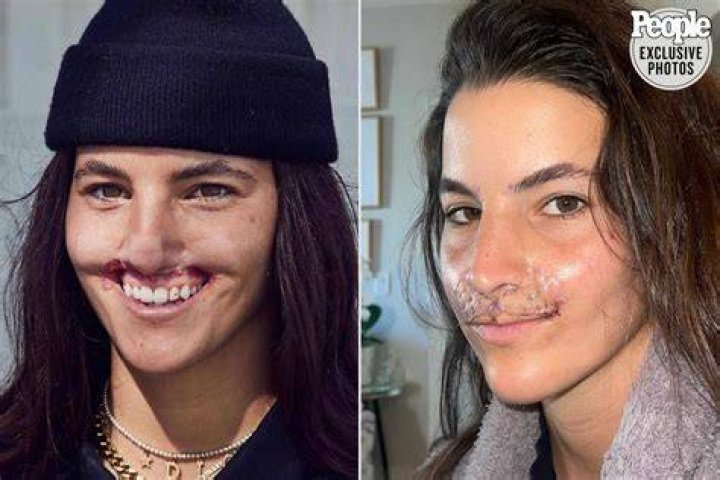 Did Dana Loesch Undergo Surgery? Illness And Health Update 2022 – What Happened To Her?