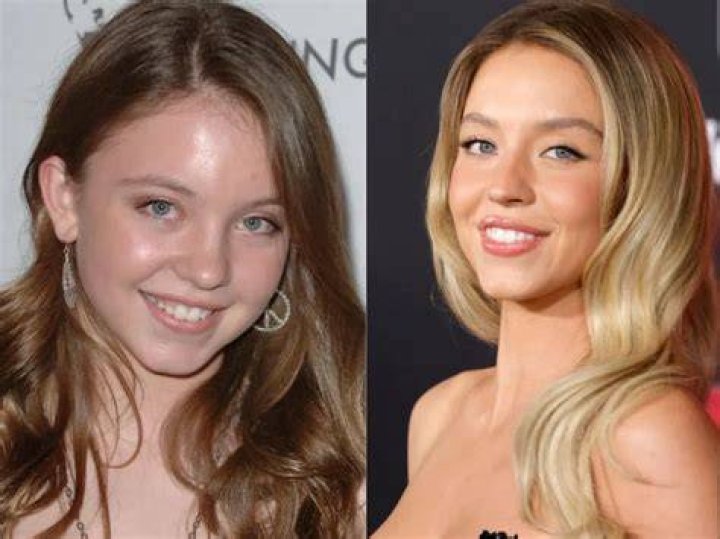 
Did Erin Darke Get Her Nose Done? Before And After Photos 
