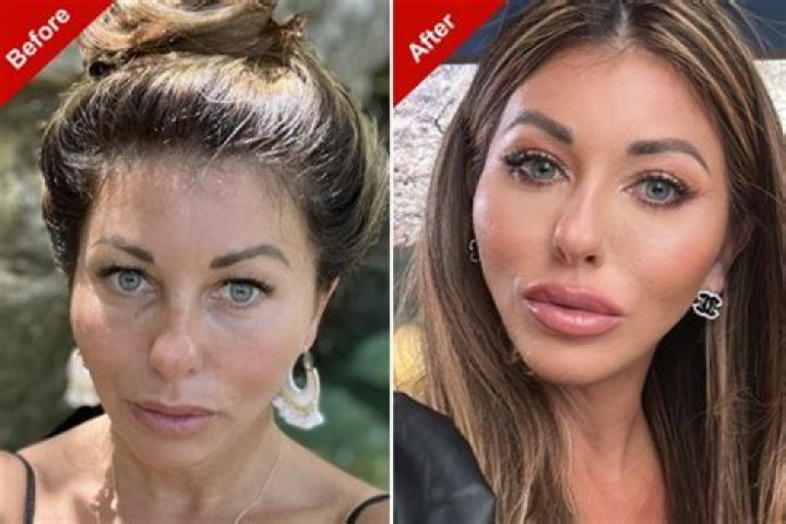 Did Holly Sonders Have Plastic Surgery Done? Fans Are Curious About The Golfer As She Gets More Popular