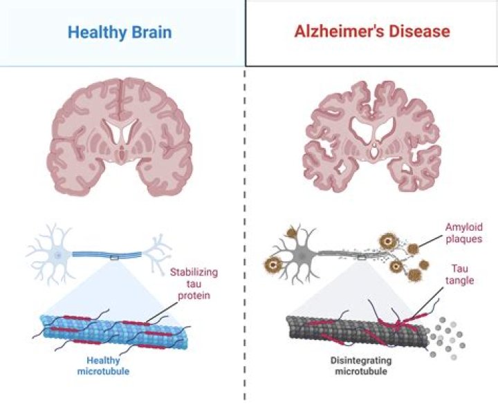 
Does MontanaBlack Have Alzheimer Disease? Get To Know About The Youtuber’s Health Condition 