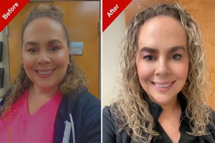 Has Alexandra Rose Had Plastic Surgery On Chin? Before And After Photos On IG