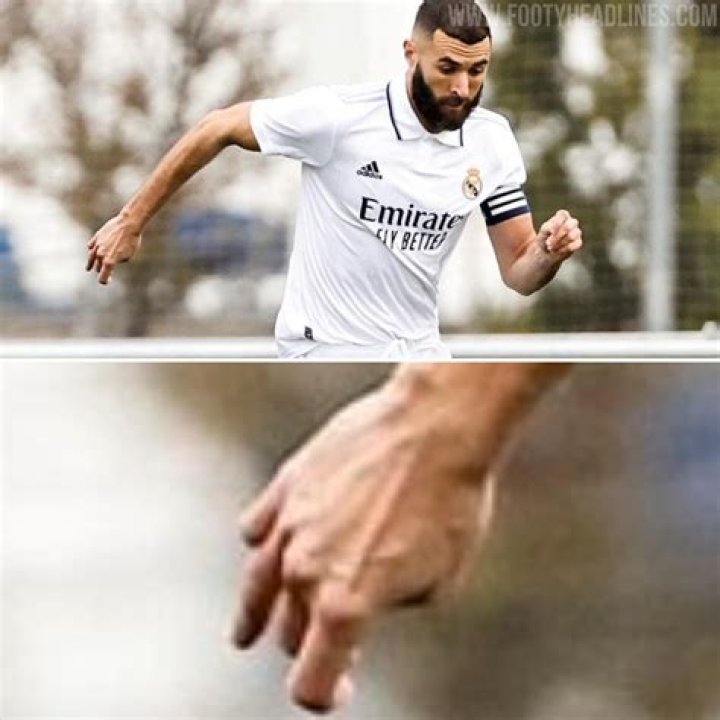 
Health Update: What Happened To Benzema Hand? Has Real Madrid Striker Done Surgery? 