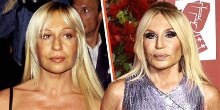 Marijana Veljovic Plastic Surgery Adds Years To Her Face
