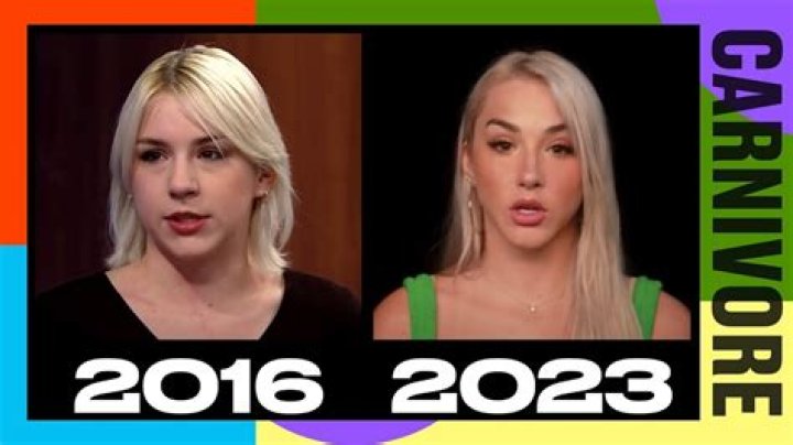 Mikhaila Peterson Plastic Surgery | Before And After Photos