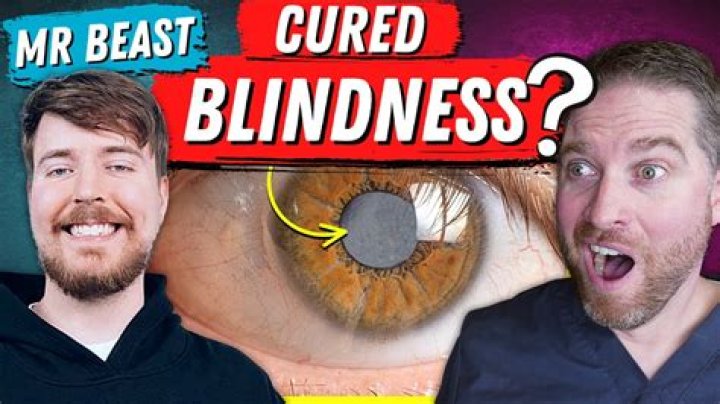 
Mr Beast | Provided Eye Surgery To 1000 Blind People 