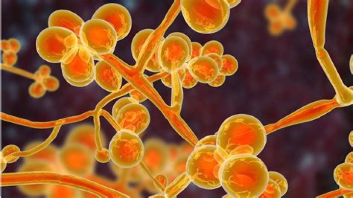 
What is Candida auris? Symptoms explored as CDC issues warning about deadly fungus spreading across the U.S. 