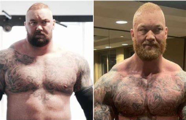 
What’s Wrong With Thor Bjornsson’s Face? Icelandic Strongman Dating Life Explored 